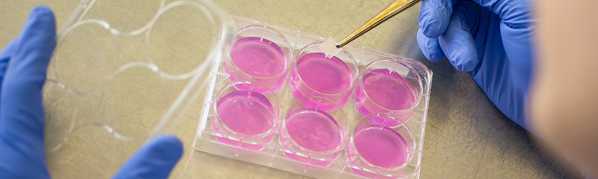 In vitro tissue-based testing methods help assess irritation potential of medical device extracts without the use of animal models.